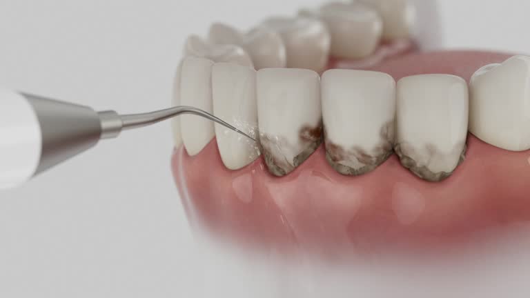 Trusted Teeth Cleaning And Checkup service in East Pepperell, MA - Dentist Open Now